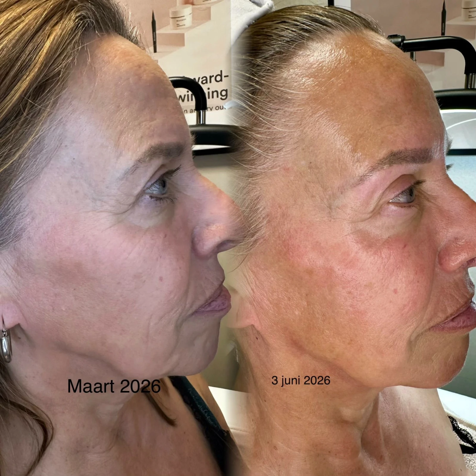 photo - Schoonheidssalon Rijswijk | By Jaimy