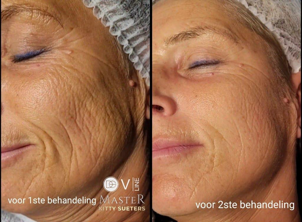 photo - Schoonheidssalon Rijswijk | By Jaimy